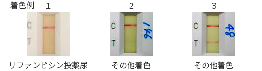 投薬や血尿などの影響で尿に着色がある場合、POCの測定結果に影響はありますか?